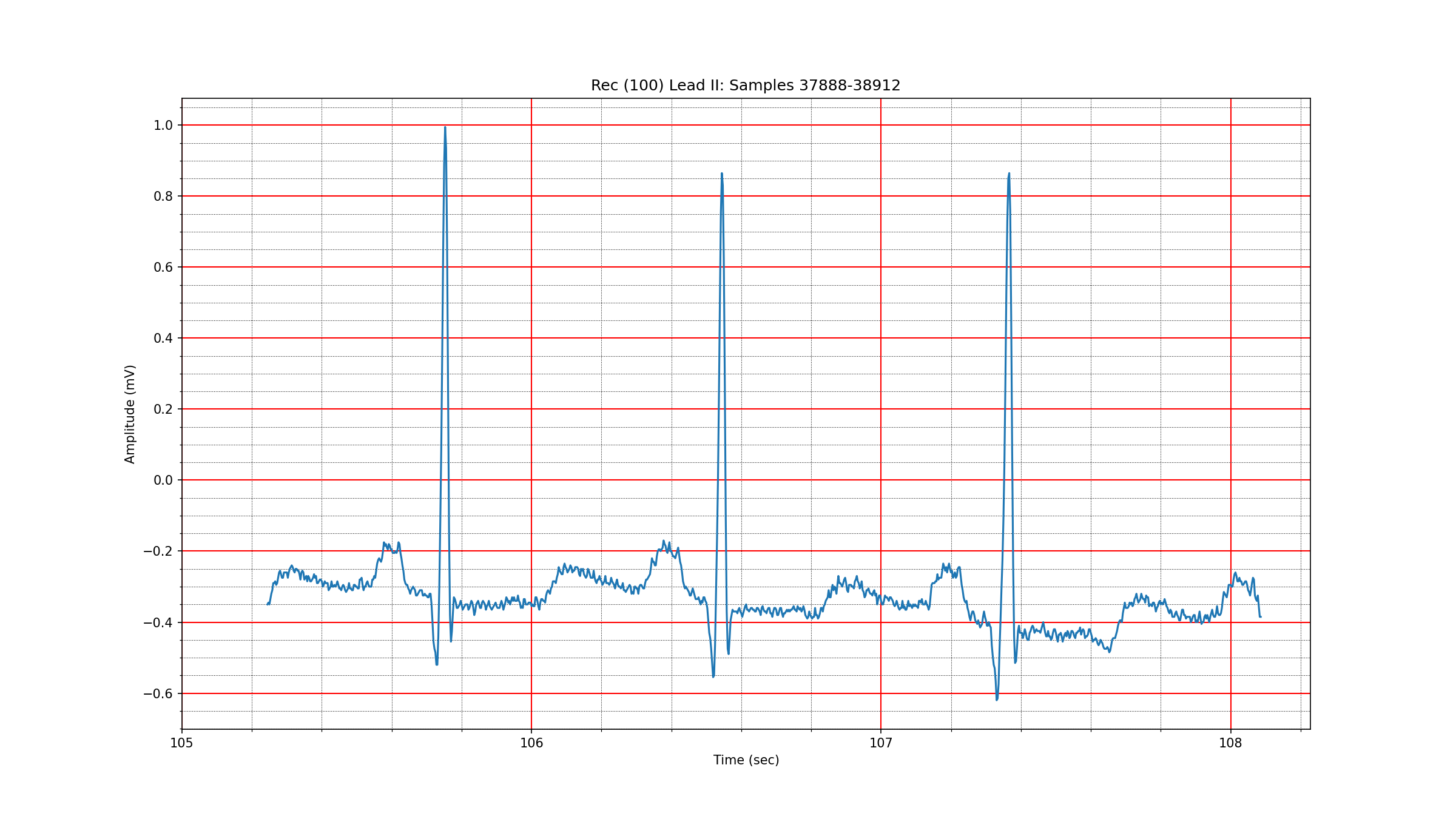 ../_images/ecg_signal_100_37888_38912.png