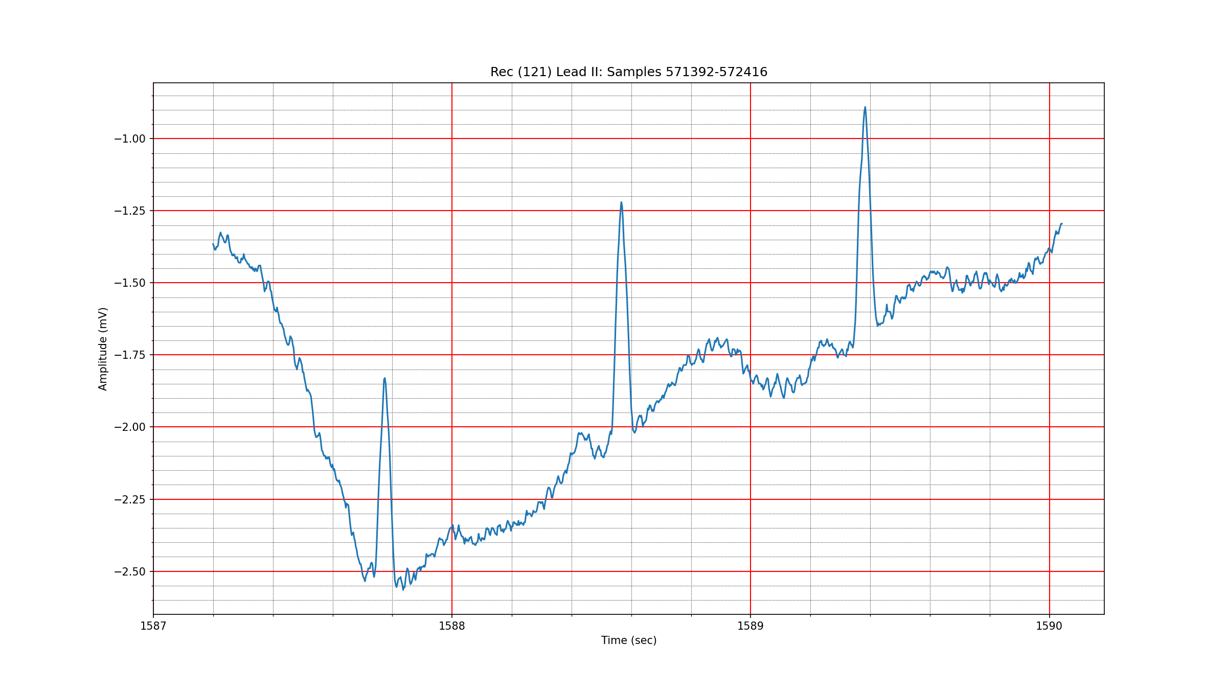 ../_images/ecg_signal_121_571392_572416.png