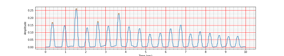 ECG peaks after moving average bad